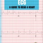 ECG - A Guide to Read a Heart